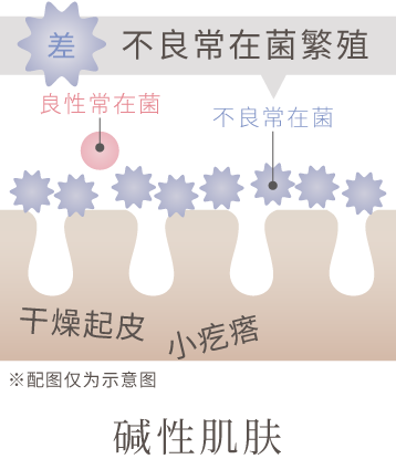 恶玉菌繁殖！ 粗糙・干燥　碱性的肌肤　※此为示意图